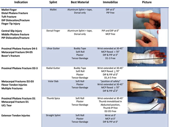 The most significant hazard associated with splinting is